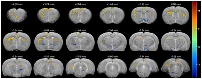 Acute psilocybin increased cortical activities in rats